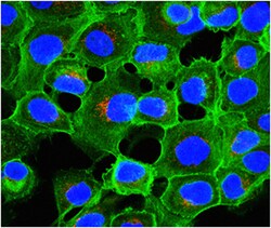 MilliporeSigma anti-LBPA Clone: 6C4, 100&mu;g, Unlabeled:Antibodies, Monoclonal